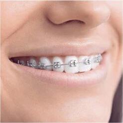 Oral B Oral-B Smartseries Teen - Elektrische Tandenborstel - Wit -SmileBright Goedkope Winkel 1198x1200 51